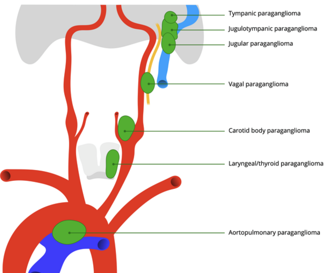Imagem7 A neurorradiologia intervencionista